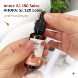 JIMERITO BEE HONEY - ELIMINA LAS CATARATAS
