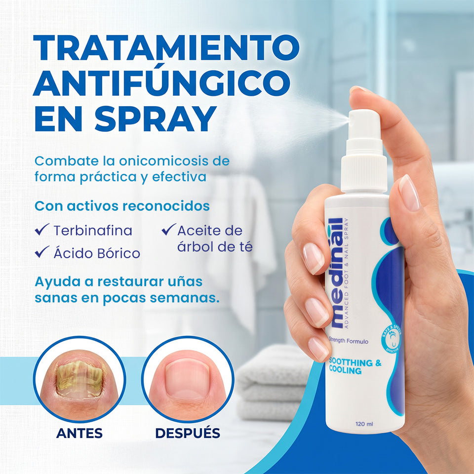 💅✨ MEDINAIL ✨💅 🌿 Spray tópico para el cuidado ungueal