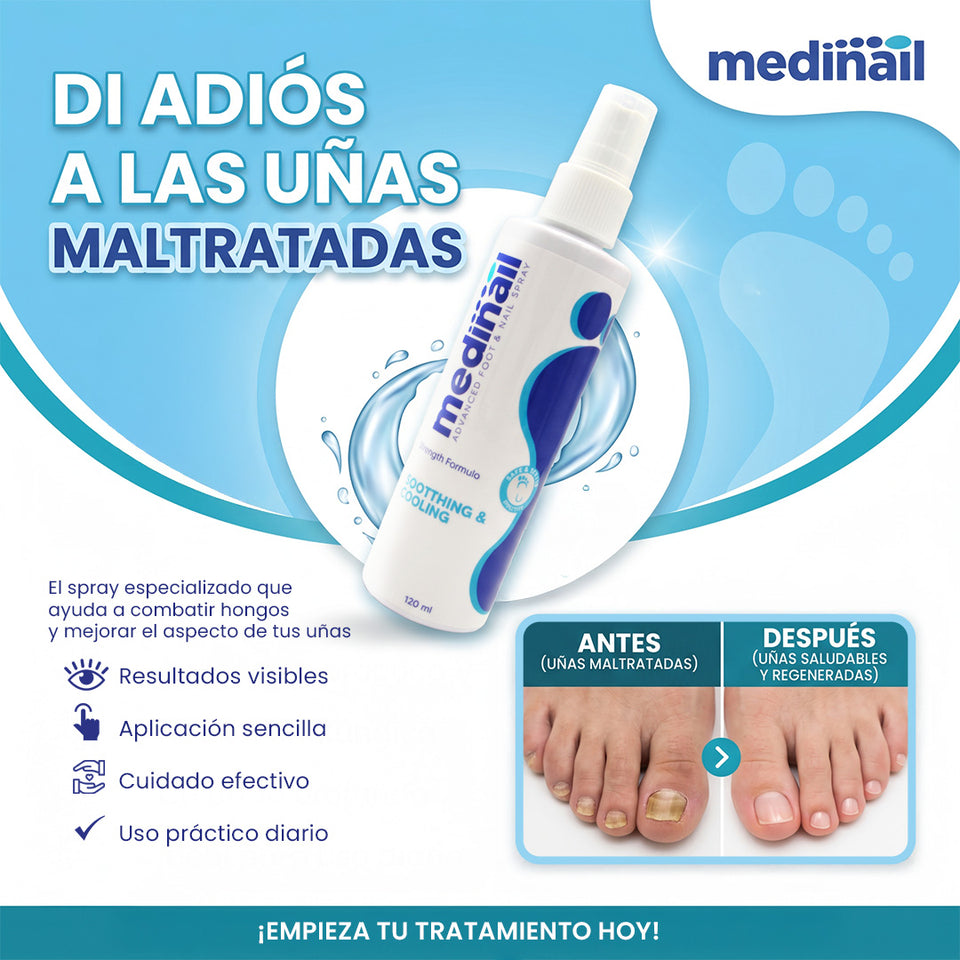 💅✨ MEDINAIL ✨💅 🌿 Spray tópico para el cuidado ungueal