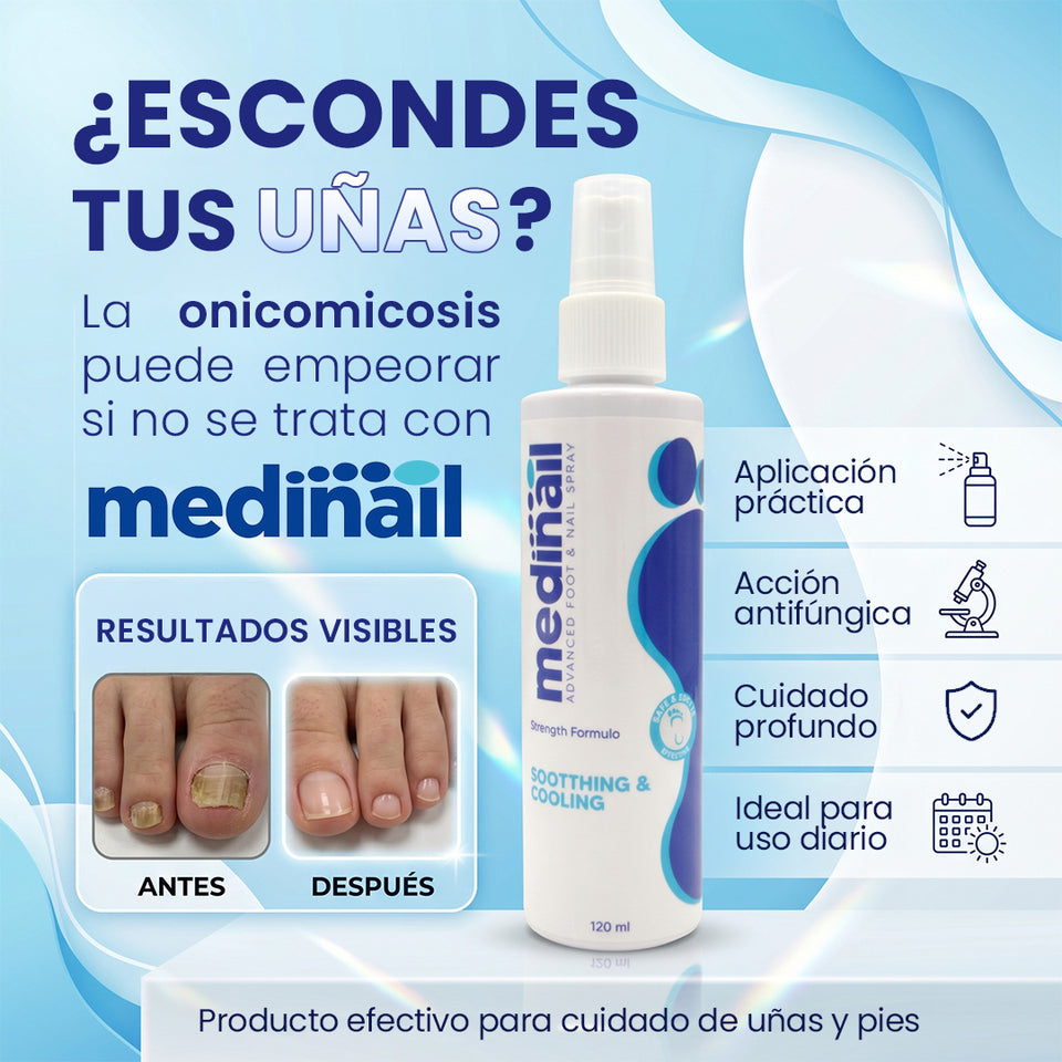 💅✨ MEDINAIL ✨💅 🌿 Spray tópico para el cuidado ungueal